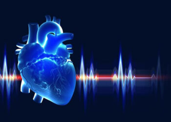 TEE is becoming an integral part of cardiac surgeries-Dr. Shweta Yemul Golhar